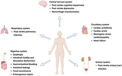 Role of the gut microbiota in complications after ischemic stroke